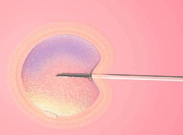 大家冻胚怀孕周期怎么算,试管婴儿,移植后。